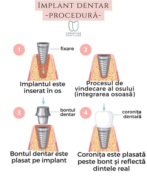 Creative Dentline, clinica stomatologica Alba Iulia