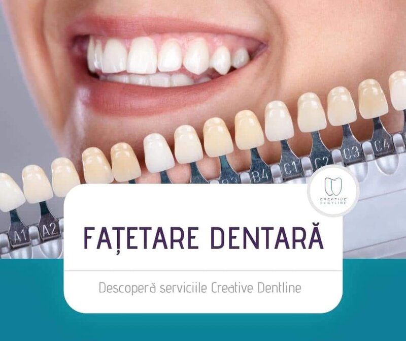Creative Dentline, clinica stomatologica Alba Iulia